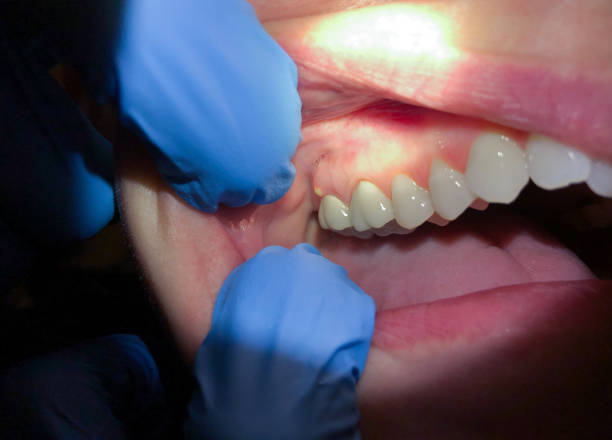 Best Cosmetic Emergency Dentistry in Englewood, NJ