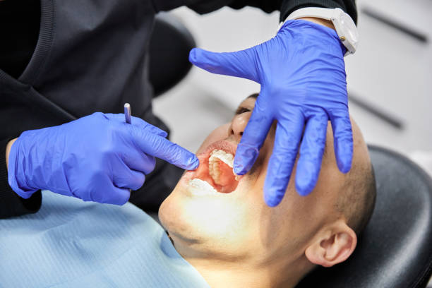 Best Emergency Tooth Extraction in Englewood, NJ
